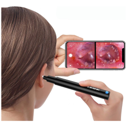 scópio, Digital, Com Camera, Profissional, L LIMINK LM OTO XZ, Preto