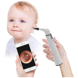 Otoscópio Sem Fio com Câmera de Orelha HD 720P, 6 Luzes LED e Ferramenta de Remoção de Cera, Compatível com iPhone e Android, ScopeAround