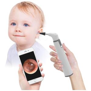 Otoscópio Sem Fio com Câmera de Orelha HD 720P, 6 Luzes LED e Ferramenta de Remoção de Cera, Compatível com iPhone e Android, ScopeAround