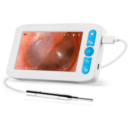 Otoscópio, Digital, Com Camera, Profissional, 32GB, SEESII, Prateado