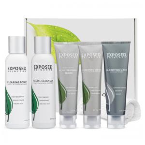 Kit Cuidados com a Pele para Tratamento de Acnes, EXPOSED SKIN CARE AKNM, Branco