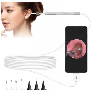 Otoscópio, Digital, Com Camera, Profissional, SCOPEAROUND, Preto