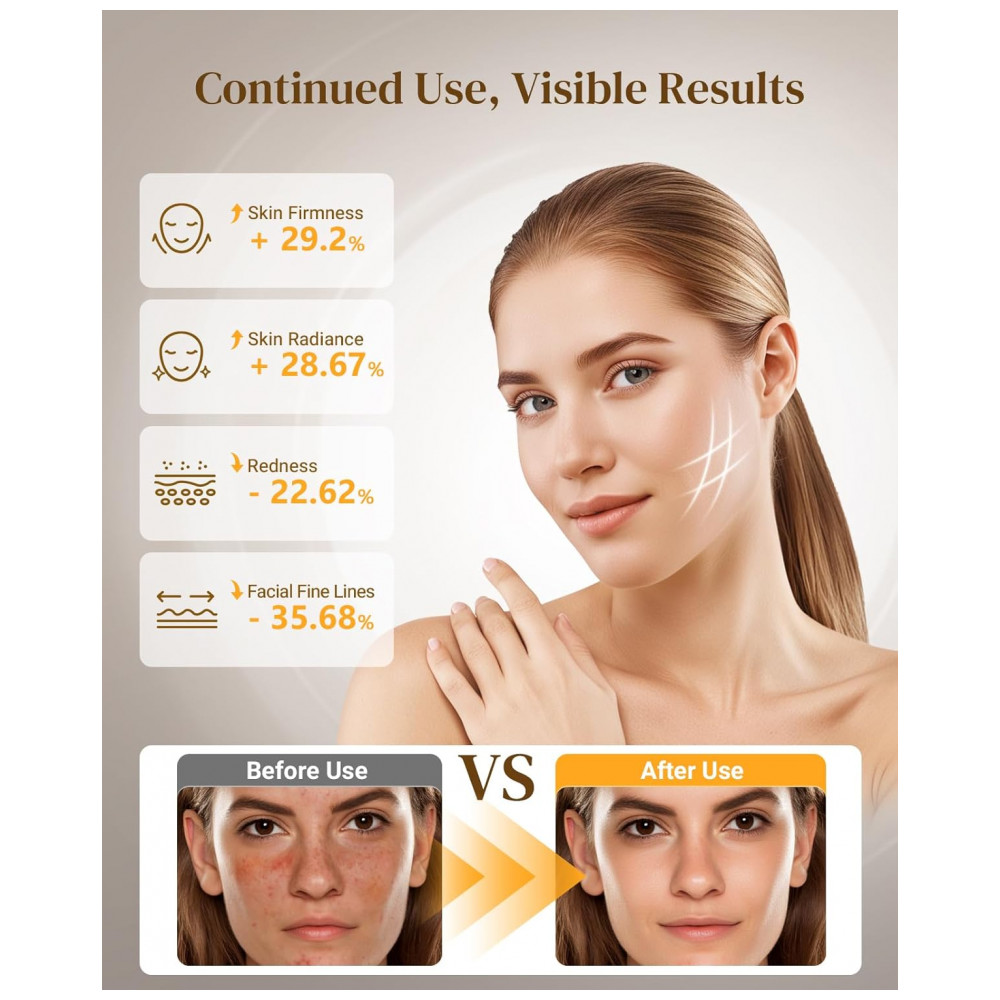 ECTQF353349F0B_1-1.jpg - Máscara de Terapia de Luz Vermelha para o Rosto, Máscara Facial LED Sem Fio, Design Recarregável com Temporizador Ajustável e Display Digital para Cui