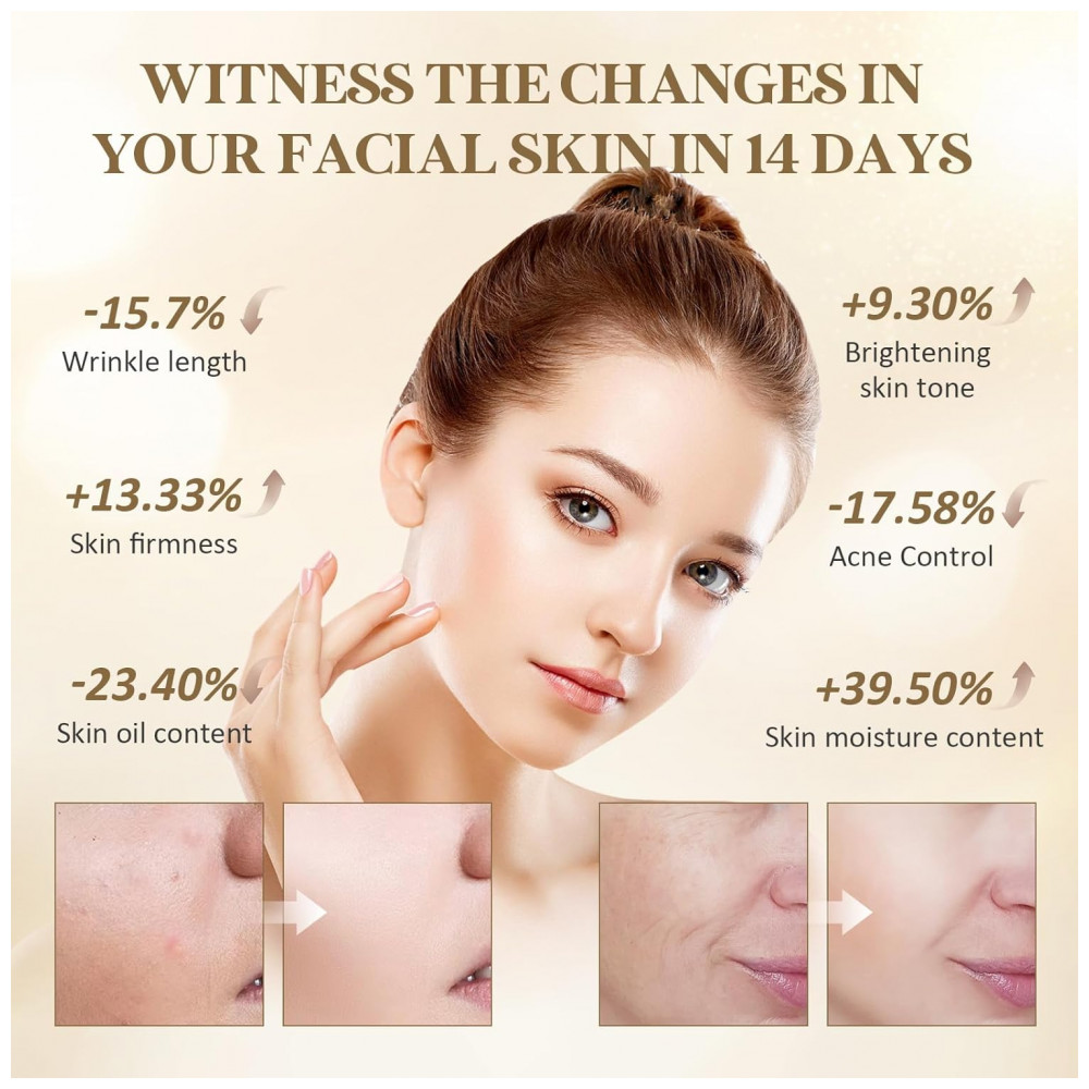 ECTQFVRCTC4F0B_2-1.jpg - Máscara de LED com Terapia de Luz, Luz Vermelha para Rugas e Luz Azul para Acne - Kit Recarregável de 1 Unidade