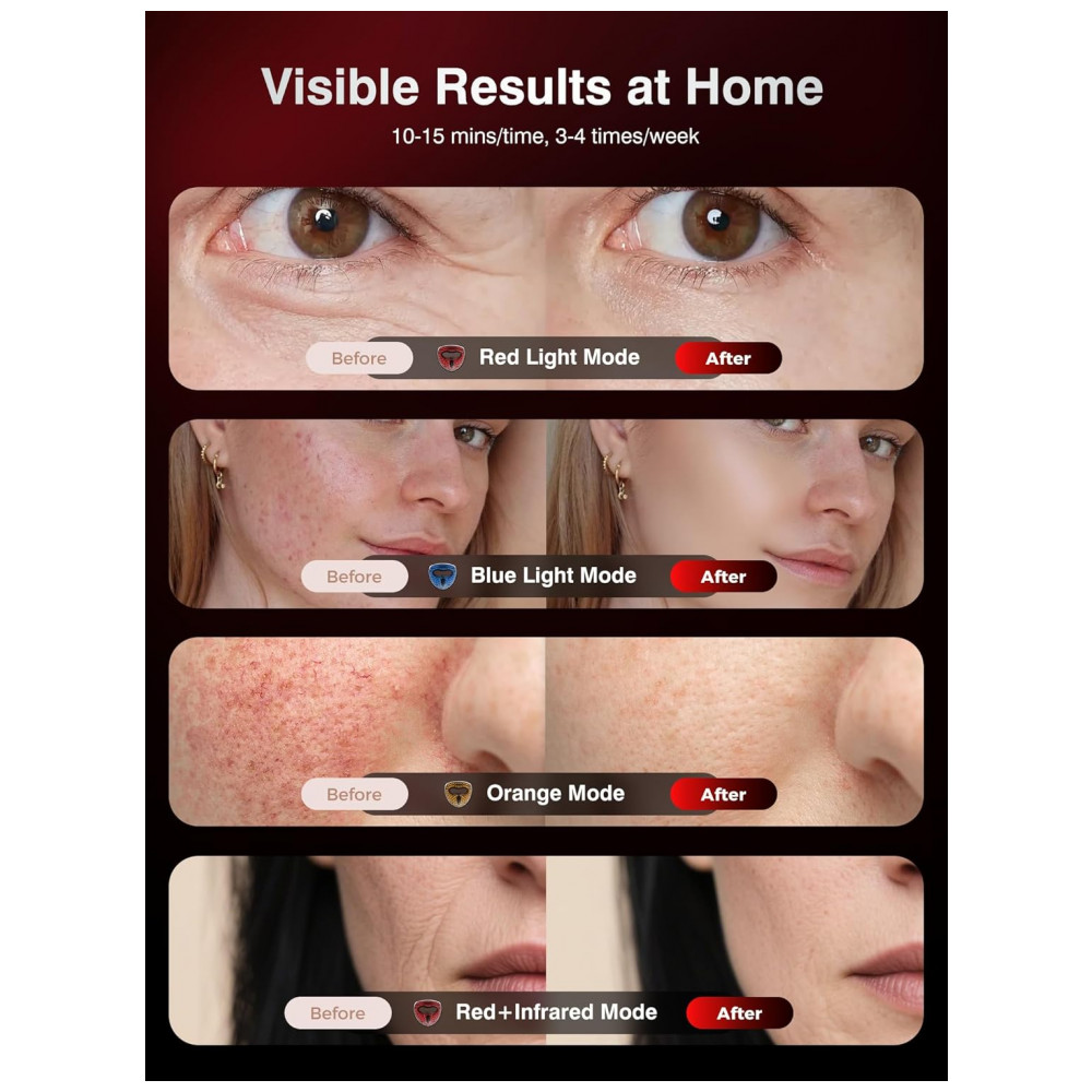 ECTQWVXK8Q8F0B_5-1.jpg - Máscara de Terapia de Luz Vermelha 4D para o Rosto INTEO com 4 Modos de Luz Vermelha, Infravermelha, Azul e Laranja, Máscara de LED Infravermelho de 8